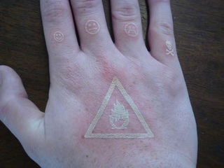 Illustration for article titled Guy Uses Laser-Etch Machine to Tattoo Himself (Verdict: Flaming Nutcase)